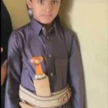 فاجعة مأساوية في شبوة.. طفل يلقى حتفه بعد عضّة قط والسبب! 