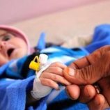 مسؤول أممي: سوء التغذية طال نحو نصف أطفال اليمن جراء الأزمة الإنسانية