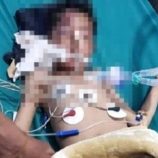 إصابة امرأة وطفليها في حادث سير مروع في دمت