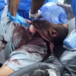 ارتفاع حصيلة ضحايا إطلاق النار في مدينة عتق إلى 4 شهداء وأكثر من 28 جريحاً