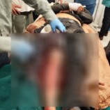 مقتل مسن برصاص قنّاص حوثي في تعز