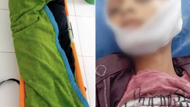 مقتل امرأة وطفل وإصابة 6 مدنيين بقصف حوثي في تعز