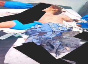 الضالع: إصابة طفلة بانفجار بقايا مقذوف متفجر أثناء توجهها إلى المدرسة